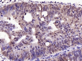 Phospho-c-Jun (Ser63) Rabbit Polyclonal Antibody