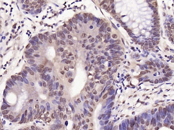 Phospho-c-Jun (Ser63) Rabbit Polyclonal Antibody