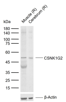 CSNK1G2 Rabbit Polyclonal Antibody