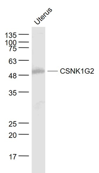 CSNK1G2 Rabbit Polyclonal Antibody