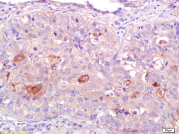 CNR2 Rabbit Polyclonal Antibody