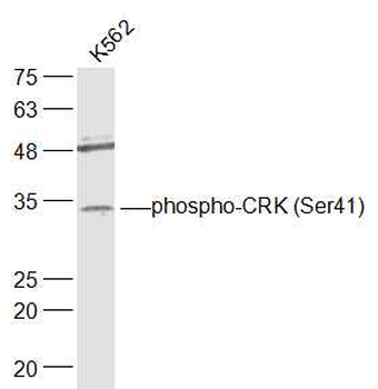 Phospho-CRK (Ser41) Rabbit Polyclonal Antibody