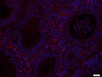 EpCAM Rabbit Polyclonal Antibody (PE)