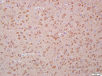 LC3A Mouse Monoclonal Antibody