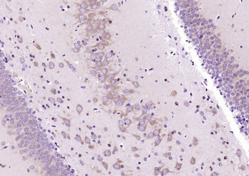 MEK2 Mouse Monoclonal Antibody