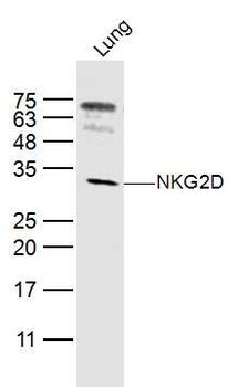NKG2D Rabbit Polyclonal Antibody