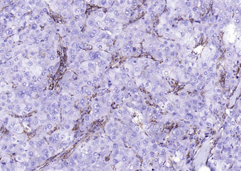 CD14 Rabbit Polyclonal Antibody