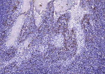 CD14 Rabbit Polyclonal Antibody