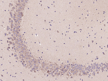 Beta IV Tubulin Rabbit Polyclonal Antibody