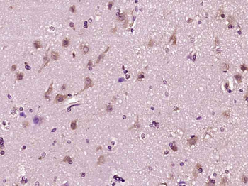 VEGF-C Rabbit Polyclonal Antibody