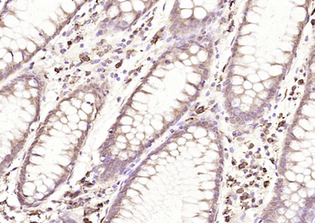 VEGF-C Rabbit Polyclonal Antibody