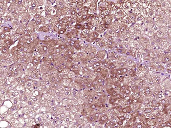 VEGF-C Rabbit Polyclonal Antibody