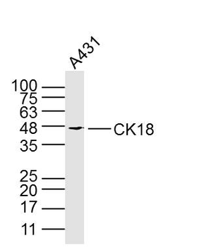 CK18 Mouse Monoclonal Antibody