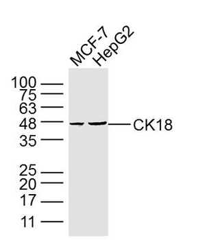 CK18 Mouse Monoclonal Antibody
