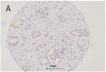 ZO-1/TJP1 Rabbit Polyclonal Antibody