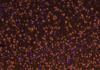C-Maf Rabbit Polyclonal Antibody