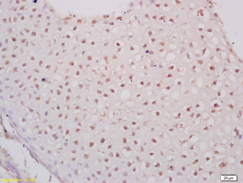 PAX6 Rabbit Polyclonal Antibody