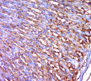 PIAS1 Rabbit Polyclonal Antibody