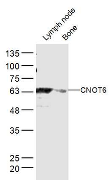 CNOT6 Rabbit Polyclonal Antibody