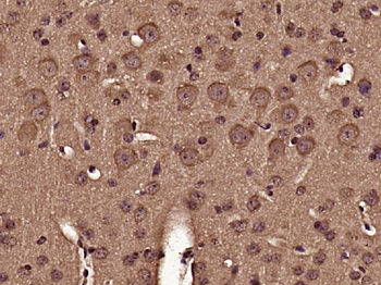 LC3A/B Rabbit Polyclonal Antibody