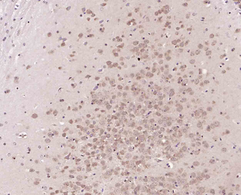NUCB2 Rabbit Polyclonal Antibody
