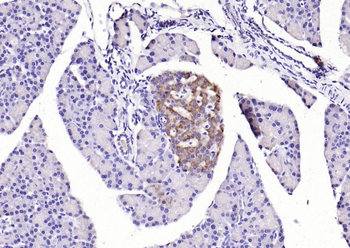 GPR49/LGR5 Rabbit Polyclonal Antibody