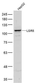 GPR49/LGR5 Rabbit Polyclonal Antibody