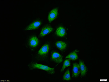 IL-1R1 Rabbit Polyclonal Antibody