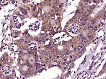 IL-1R1 Rabbit Polyclonal Antibody