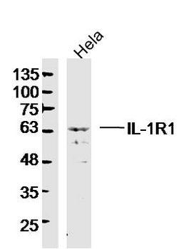 IL-1R1 Rabbit Polyclonal Antibody