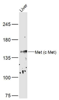 MET Rabbit Polyclonal Antibody