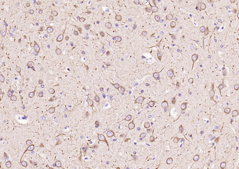 Beta tubulin Mouse Monoclonal Antibody (Loading Control)