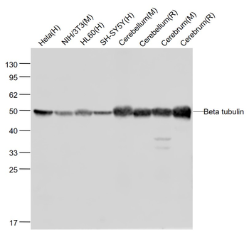 Beta tubulin Mouse Monoclonal Antibody (Loading Control)
