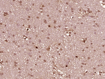 Ku70 / XRCC6 Rabbit Polyclonal Antibody