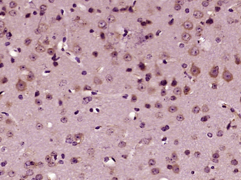 Gamma Tubulin Mouse Monoclonal Antibody