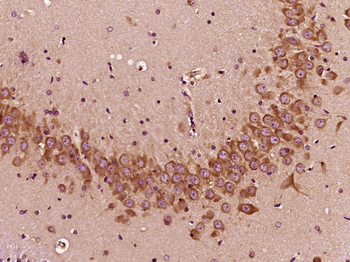 Gamma Tubulin Mouse Monoclonal Antibody