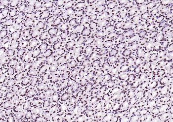 Beclin 1 Mouse Monoclonal Antibody