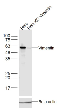Vimentin Mouse Monoclonal Antibody
