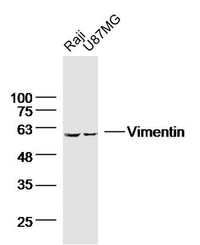 Vimentin Mouse Monoclonal Antibody