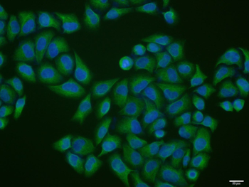 Vimentin Mouse Monoclonal Antibody