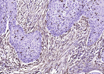 Vimentin Mouse Monoclonal Antibody