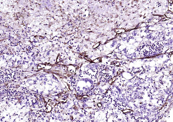 Vimentin Mouse Monoclonal Antibody