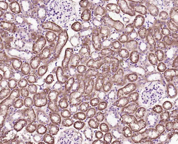 ECM1 Rabbit Polyclonal Antibody