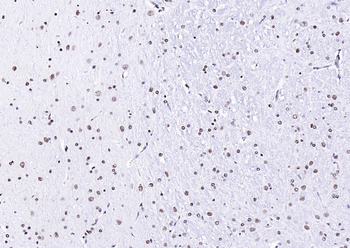 Histone H3 (di methyl K27) Mouse Monoclonal Antibody