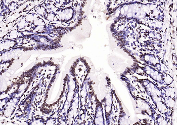 Histone H3 (di methyl K27) Mouse Monoclonal Antibody