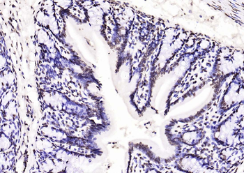 Histone H3 (di methyl K27) Mouse Monoclonal Antibody