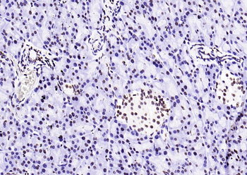 Histone H3 (di methyl K27) Mouse Monoclonal Antibody