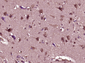 BRAF Rabbit Polyclonal Antibody