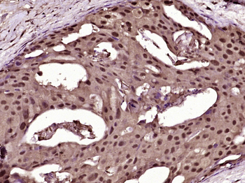 BRAF Rabbit Polyclonal Antibody