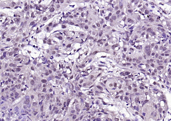 BRAF Rabbit Polyclonal Antibody